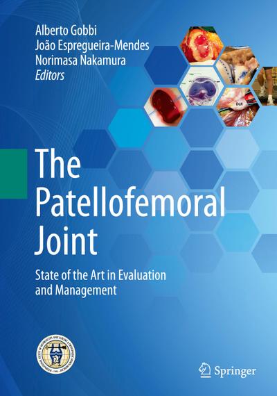 The Patellofemoral Joint