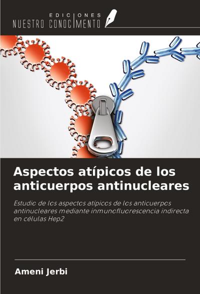 Aspectos atípicos de los anticuerpos antinucleares