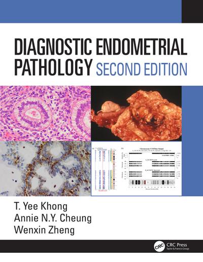 Diagnostic Endometrial Pathology 2E