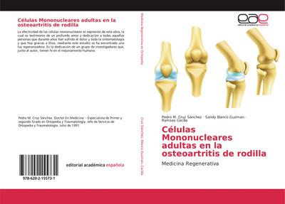 Células Mononucleares adultas en la osteoartritis de rodilla