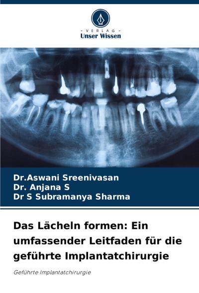 Das Lächeln formen: Ein umfassender Leitfaden für die geführte Implantatchirurgie