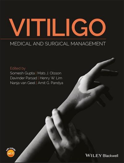 Vitiligo