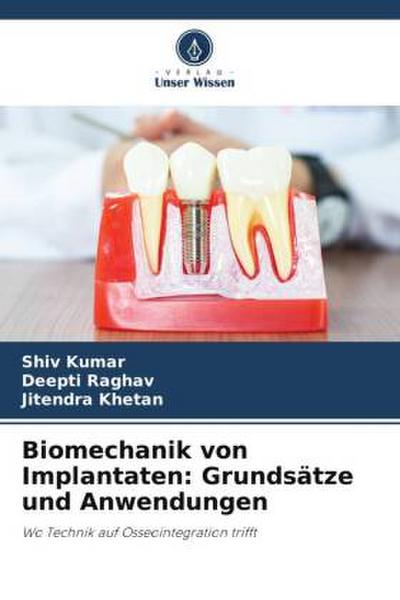 Biomechanik von Implantaten: Grundsätze und Anwendungen