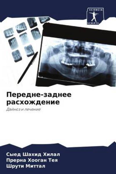 Peredne-zadnee rashozhdenie