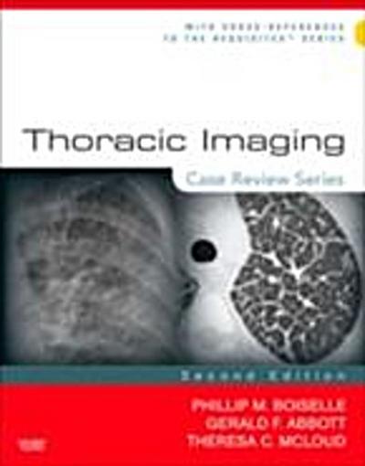 Thoracic Imaging: Case Review Series