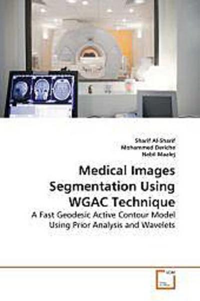 Medical Images Segmentation Using WGAC Technique