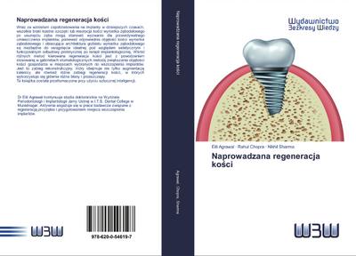 Naprowadzana regeneracja ko¿ci