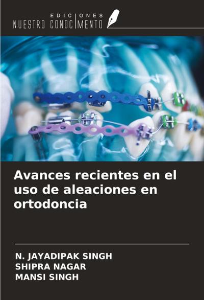 Avances recientes en el uso de aleaciones en ortodoncia