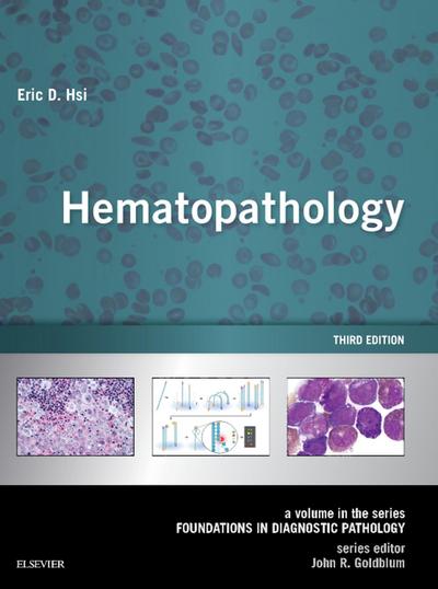 Hematopathology E-Book