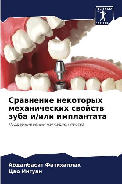 Srawnenie nekotoryh mehanicheskih swojstw zuba i/ili implantata