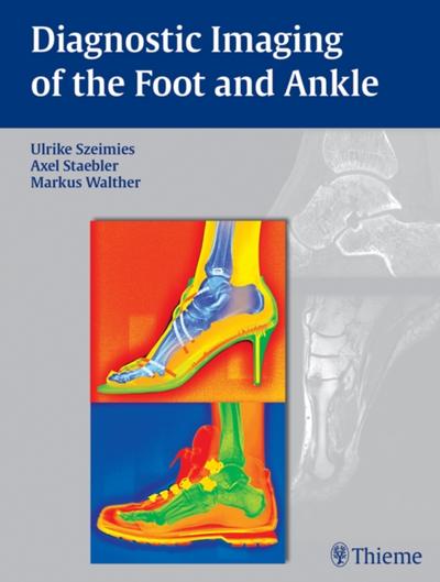 Diagnostic Imaging of the Foot and Ankle