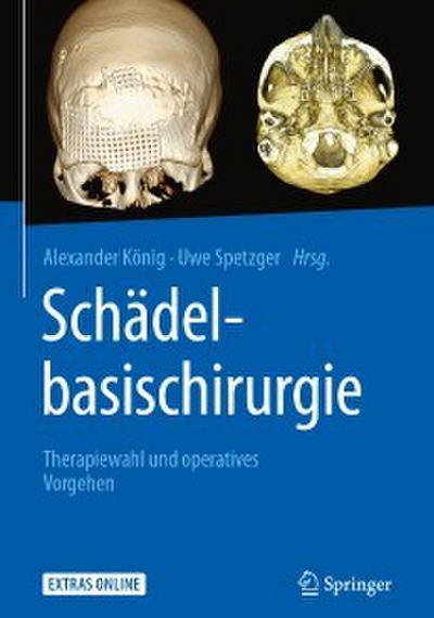 Schädelbasischirurgie