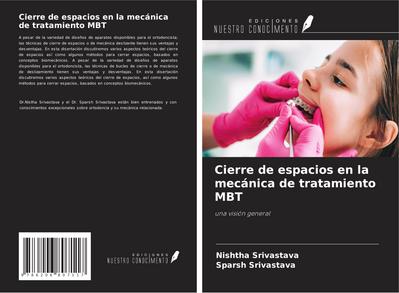 Cierre de espacios en la mecánica de tratamiento MBT