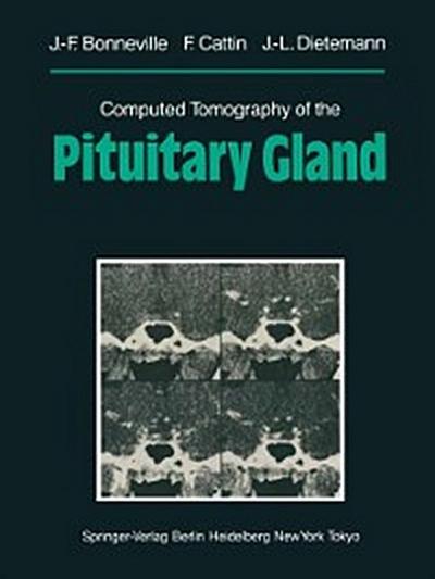 Computed Tomography of the Pituitary Gland