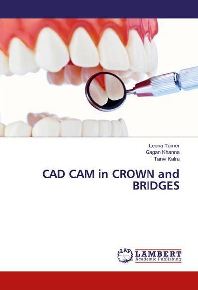 CAD CAM in CROWN and BRIDGES