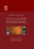 Atlas chorob siatkowki - Lawrence A. Yannuzzi