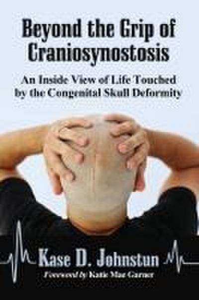 Beyond the Grip of Craniosynostosis
