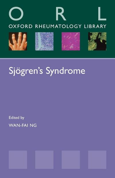 Sjogren’s Syndrome