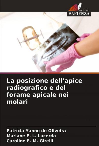 La posizione dell’apice radiografico e del forame apicale nei molari