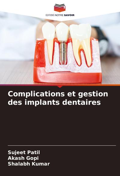 Complications et gestion des implants dentaires