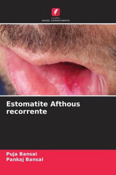 Estomatite Afthous recorrente