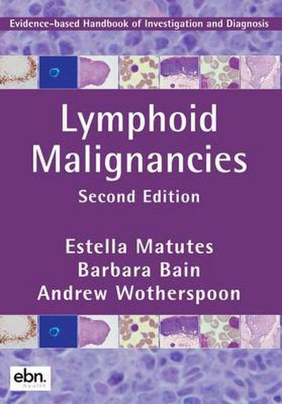 Lymphoid Malignancies