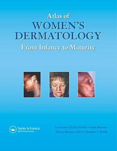 Atlas of Women’s Dermatology