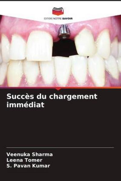 Succès du chargement immédiat