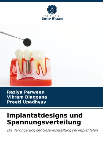 Implantatdesigns und Spannungsverteilung