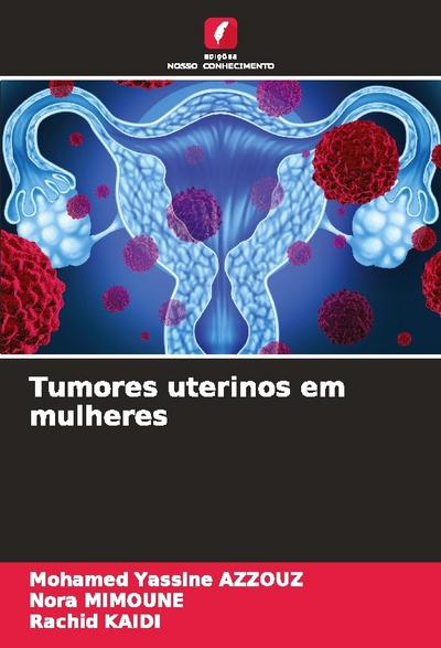 Tumores uterinos em mulheres