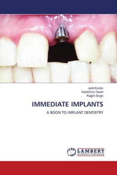 IMMEDIATE IMPLANTS