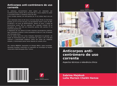 Anticorpos anti-centrómero de uso corrente