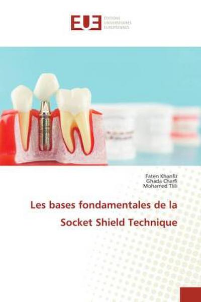 Les bases fondamentales de la Socket Shield Technique