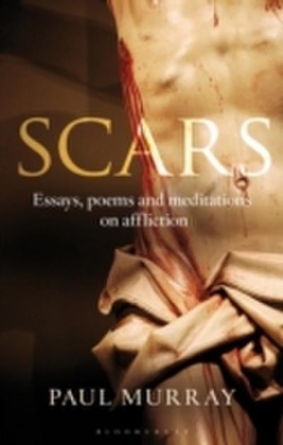 Scars