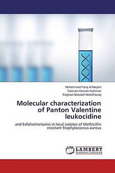 Molecular characterization of Panton Valentine leukocidine