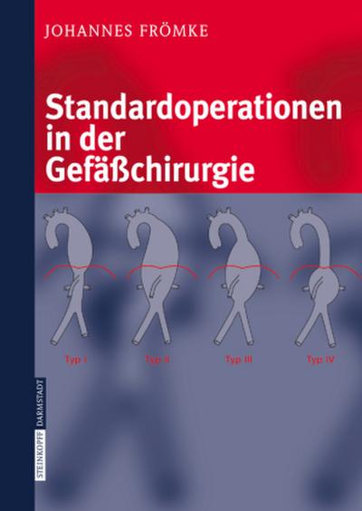 Standardoperationen in der Gefäßchirurgie