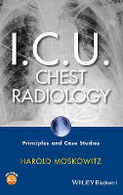 I.C.U. Chest Radiology