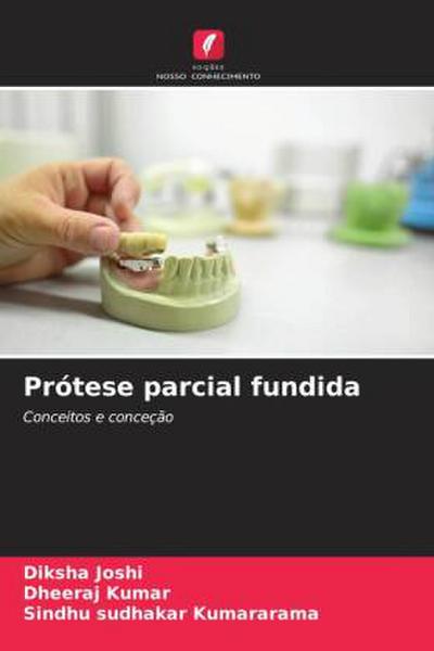 Prótese parcial fundida