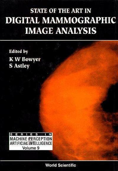 State of the Art in Digital Mammographic Image Analysis