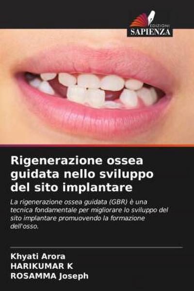 Rigenerazione ossea guidata nello sviluppo del sito implantare