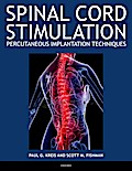 Spinal Cord Stimulation