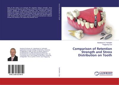 Comparison of Retention Strength and Stress Distribution on Tooth