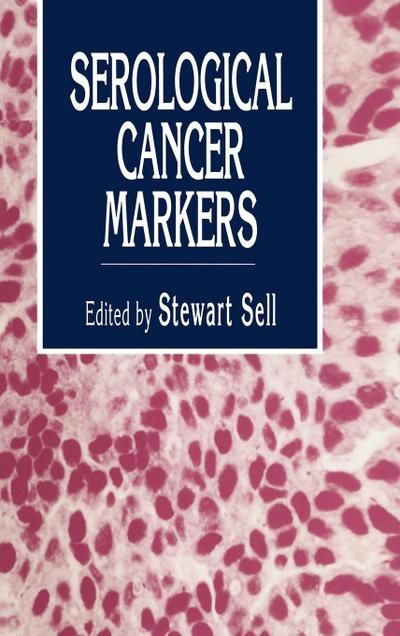 Serological Cancer Markers