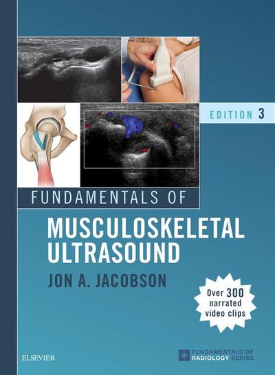 Fundamentals of Musculoskeletal Ultrasound E-Book