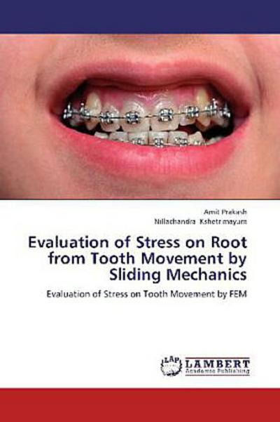 Evaluation of Stress on Root from Tooth Movement by Sliding Mechanics