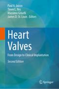 Heart Valves