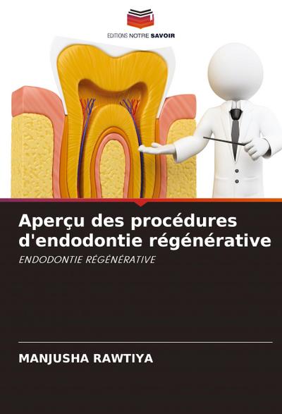 Aperçu des procédures d’endodontie régénérative