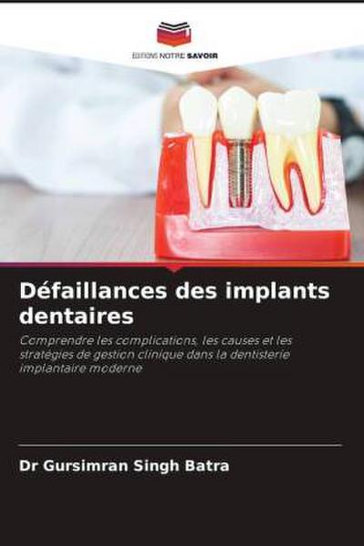 Défaillances des implants dentaires