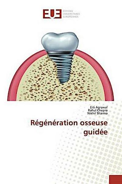 Régénération osseuse guidée