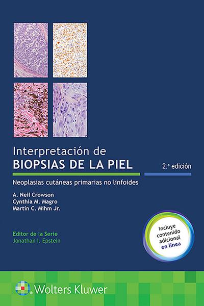 Interpretacion De Biopsias De La Piel. Neoplasias Cutáneas P